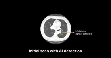Google trains AI to identify lung cancer